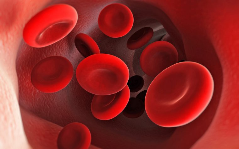 Sickle cell anemia essay