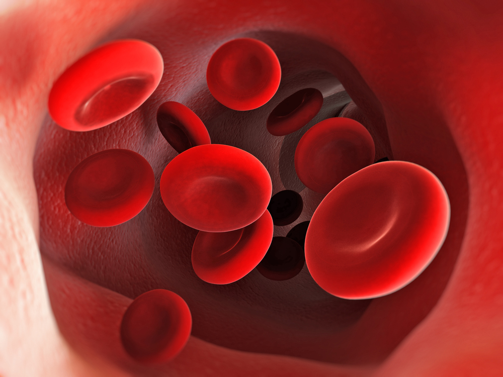 Sickle Cell Anemia Treatment Potentially Boosted by New Method of