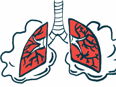 An illustration shows a pair of lungs.