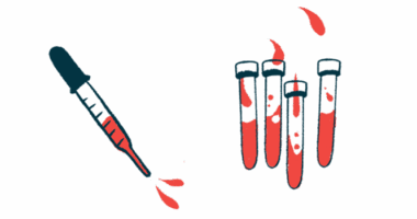 A squirting dropper is pictured alongside four half-filled vials of blood.