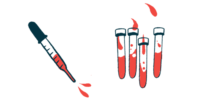 An illustration of blood in vials and a pipette.