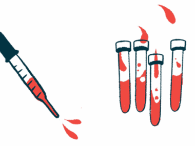 A dropper squirting blood is seen alongside four half-filled vials.