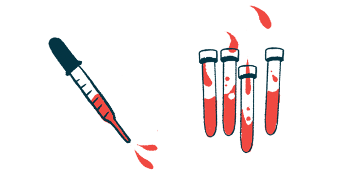 An illustration showing a dropper and vials filled with blood or another liquid.