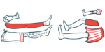 Illustration of various legs, with one showing a bandage.