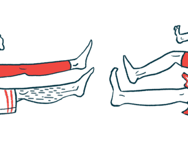 Illustration of various legs, with one showing a bandage.