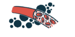 Illustration of a blood vessel.
