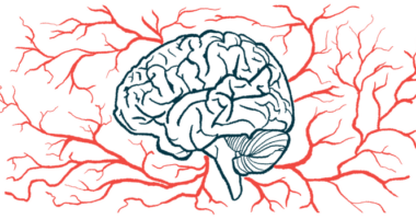 A brain is surrounded by a network of blood vessels.