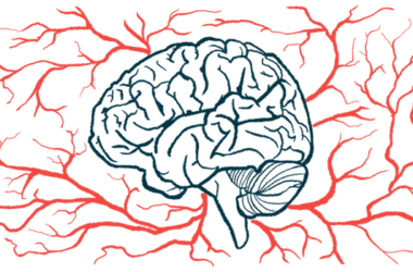 A brain is surrounded by a network of blood vessels.