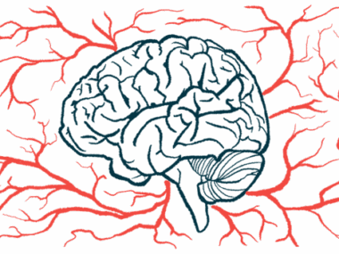 A brain is surrounded by a network of blood vessels.