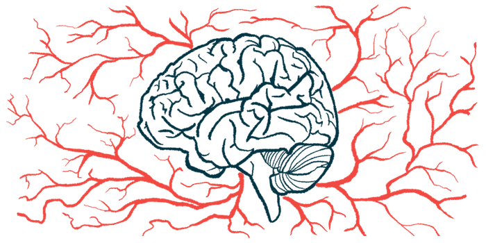 A brain is surrounded by a network of blood vessels.