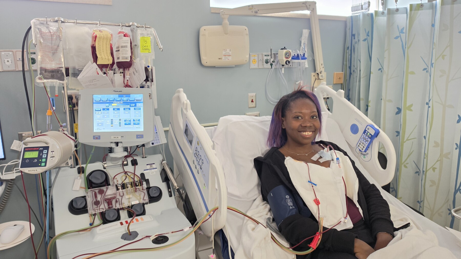 A woman lies in a hospital bed while receiving a blood exchange transfusion to treat her sickle cell disease.