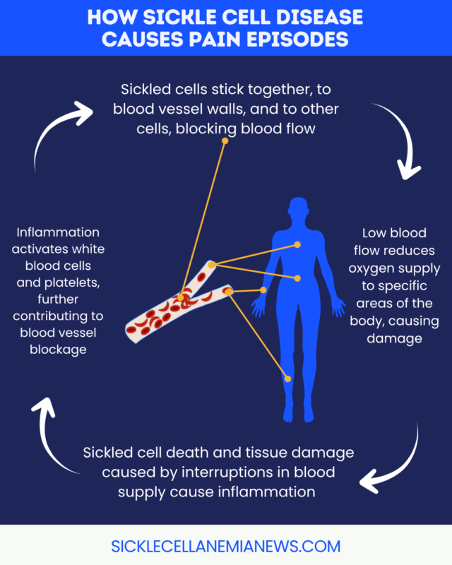A graphic illustrates how sickle cell disease causes pain episodes.