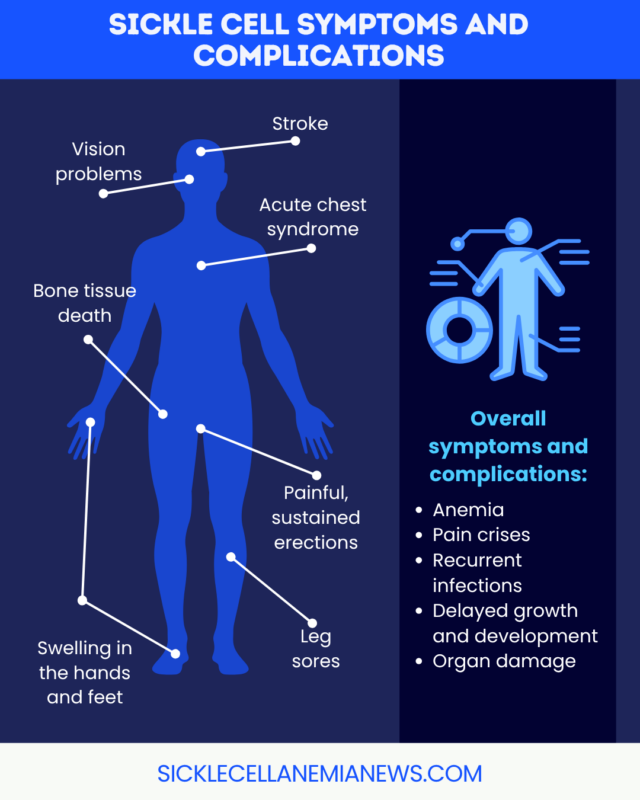 A graphic shows sickle cell symptoms and complications.